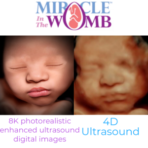 ultrasound OKC