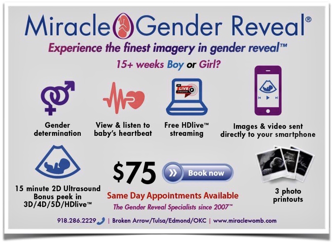 $75 Gender Reveal 15 weeks 2d elective pregnancy ultrasound
