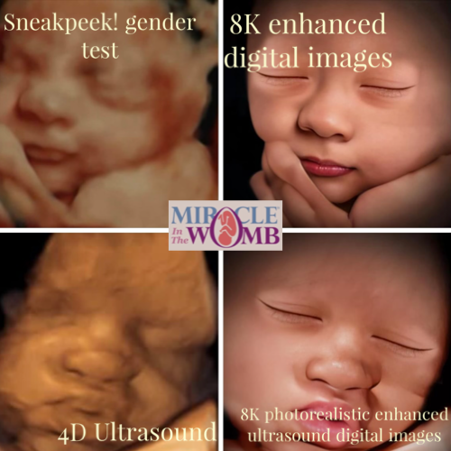 Miracle in the Womb 4d ultrasound 5d ultrasound in Tulsa and OKC area